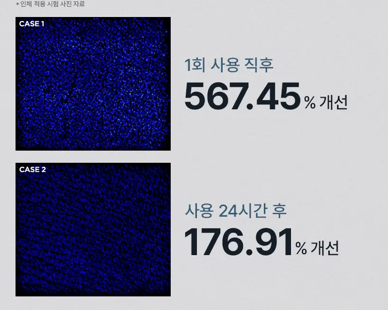 [24시간 수분충전] 미차이 히알루론산 수플레 바디크림 200G 상세페이지 11
